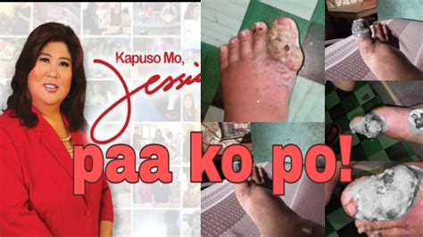 sugat sa paa in english|SUGAT Meaning in English .